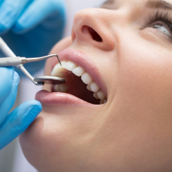 Consultation with specialist periodontist