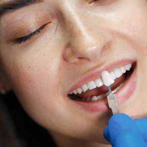 Dental Veneers: A Solution for Missing Teeth