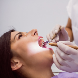 Teeth Whitening Treatment for Sensitive Teeth
